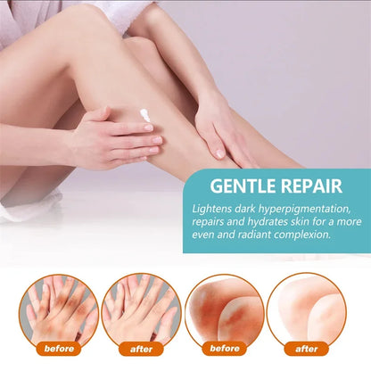 Underarm Creams for Dark Skin Body Crotch Armpit Moisturizing Korean Skincare Products 50G